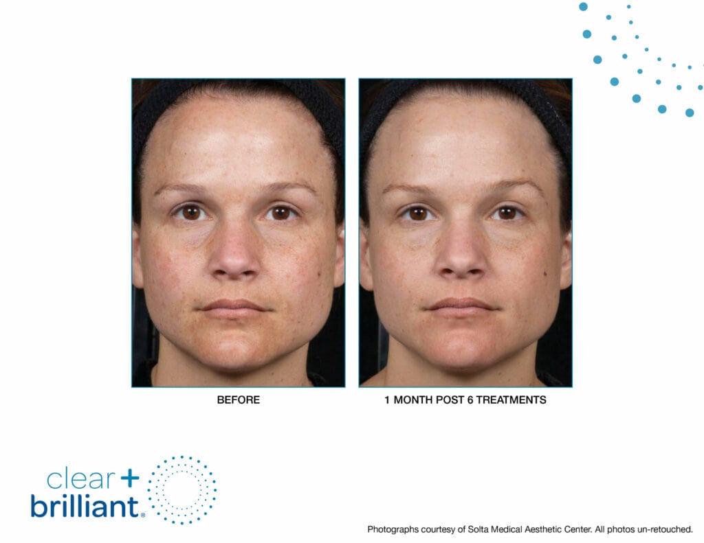 clear and brilliant before and after